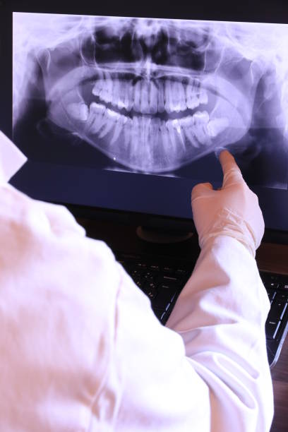 Best Teeth Whitening  in Vergennes, VT