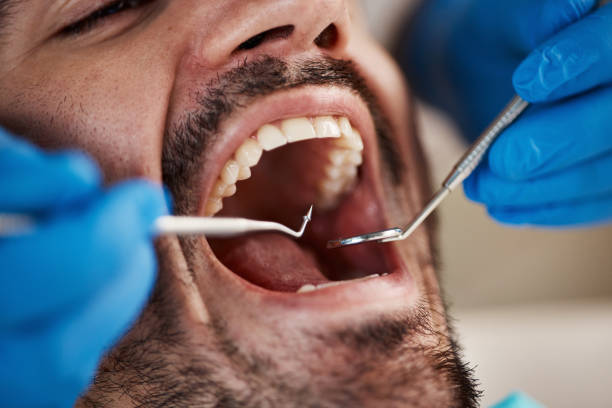 Best Chipped Tooth Repair Near Me  in Vergennes, VT