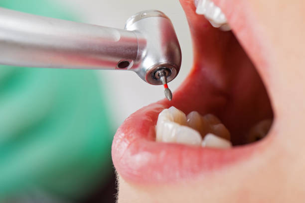 Best Emergency Dentist Open Today  in Vergennes, VT